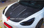 CARBON HOOD / BONNET FOR TESLA MODEL 3 2017+