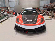 VORSTEINER STYLE DRY CARBON BODY KIT FOR FERRARI F430 2004-2009