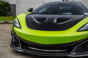 AUTHENTIC DARWINPRO CARBON HOOD BONNET P1 Style for MCLAREN 540C 570S 570GT 600LT 2015 - 2021
Set includes:

Hood Bonnet
Material: Carbon (Can be made in Forged Carbon)

NOTE: Professional installation is required