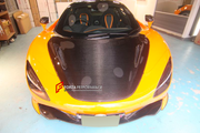 CARBON HOOD BONNET for MCLAREN 720S COUPE 2017 - 2023

Set includes:

Hood Bonnet

Material: Carbon

Note: Professional installation is required